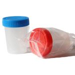 یورین باتل استریل درب دار 80ml (ظرف نمونه گیری ادرار)